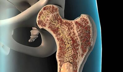 Why Bone Marrow Matters